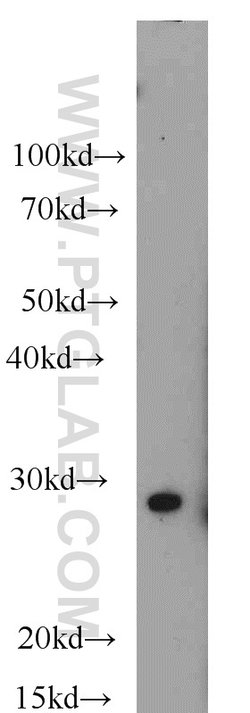 NIPSNAP3A Rabbit anti-Human, Mouse, Rat, Polyclonal, Proteintech 150 &mu;L;