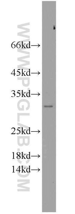 NIPSNAP3A Rabbit anti-Human, Mouse, Rat, Polyclonal, Proteintech 150 &mu;L;