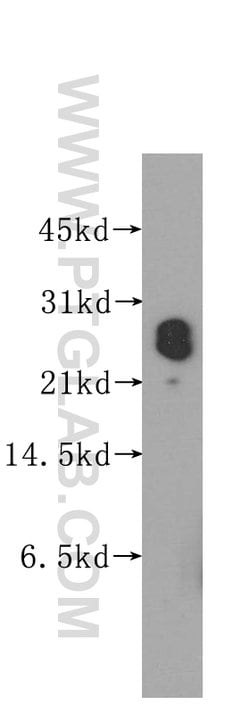 PTGDS Rabbit anti-Human, Polyclonal, Proteintech:  