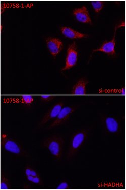 HADHA Rabbit anti-Human, Mouse, Rat, Polyclonal, Proteintech:Antibodies:Primary