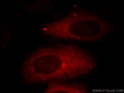 HADHA Rabbit anti-Human, Mouse, Rat, Polyclonal, Proteintech:Antibodies:Primary
