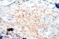 HADHA Rabbit anti-Human, Mouse, Rat, Polyclonal, Proteintech:Antibodies:Primary