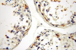 HADHA Rabbit anti-Human, Mouse, Rat, Polyclonal, Proteintech:Antibodies:Primary