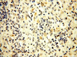 HADHA Rabbit anti-Human, Mouse, Rat, Polyclonal, Proteintech:Antibodies:Primary