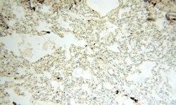 HADHA Rabbit anti-Human, Mouse, Rat, Polyclonal, Proteintech:Antibodies:Primary
