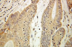 HADHA Rabbit anti-Human, Mouse, Rat, Polyclonal, Proteintech:Antibodies:Primary