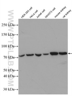 HADHA Rabbit anti-Human, Mouse, Rat, Polyclonal, Proteintech:Antibodies:Primary