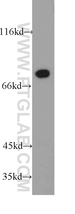 HADHA Rabbit anti-Human, Mouse, Rat, Polyclonal, Proteintech:Antibodies:Primary