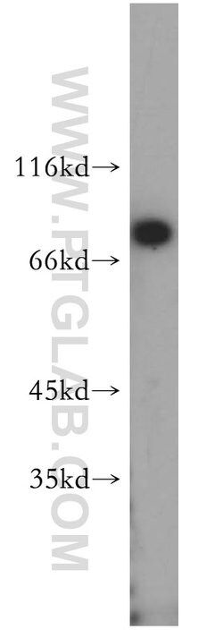 HADHA Rabbit anti-Human, Mouse, Rat, Polyclonal, Proteintech:Antibodies:Primary