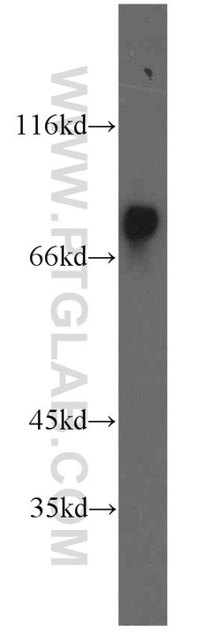 HADHA Rabbit anti-Human, Mouse, Rat, Polyclonal, Proteintech:Antibodies:Primary