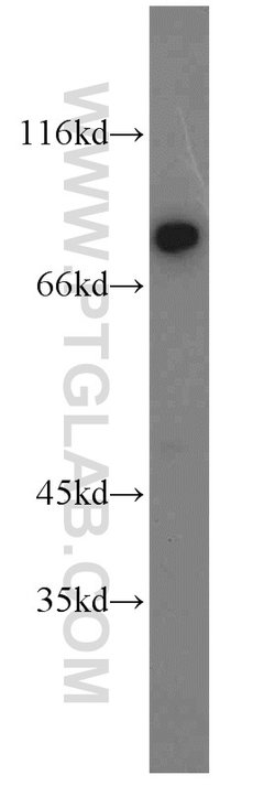 HADHA Rabbit anti-Human, Mouse, Rat, Polyclonal, Proteintech:Antibodies:Primary