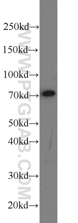 HADHA Rabbit anti-Human, Mouse, Rat, Polyclonal, Proteintech:Antibodies:Primary