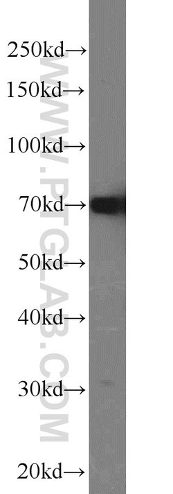 HADHA Rabbit anti-Human, Mouse, Rat, Polyclonal, Proteintech:Antibodies:Primary