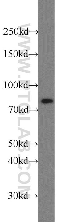 HADHA Rabbit anti-Human, Mouse, Rat, Polyclonal, Proteintech:Antibodies:Primary
