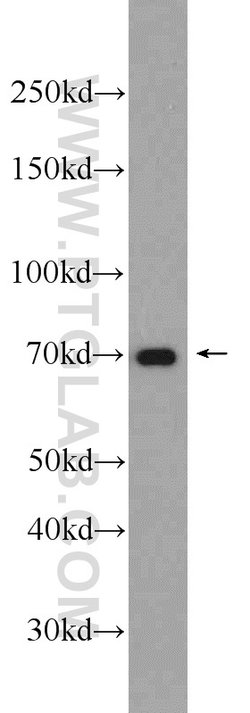 HADHA Rabbit anti-Human, Mouse, Rat, Polyclonal, Proteintech:Antibodies:Primary