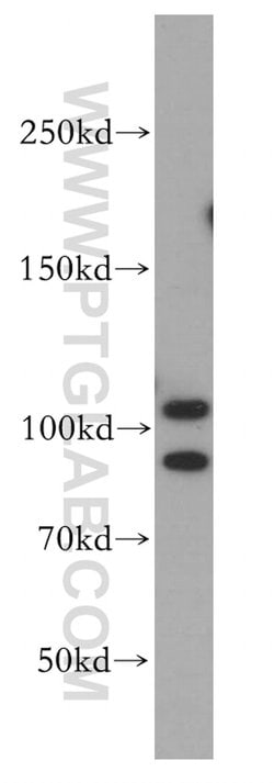SND1 Rabbit anti-Human, Mouse, Rat, Polyclonal, Proteintech 20 &mu;L; Unconjugated:Antibodies,