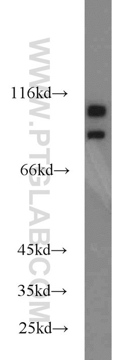 SND1 Rabbit anti-Human, Mouse, Rat, Polyclonal, Proteintech 20 &mu;L; Unconjugated:Antibodies,