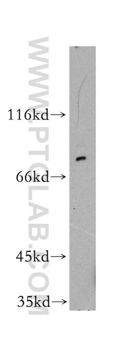 GSPT1 Rabbit anti-Human, Mouse, Rat, Polyclonal, Proteintech:Antibodies:Primary