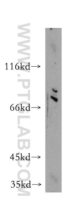 GSPT1 Rabbit anti-Human, Mouse, Rat, Polyclonal, Proteintech:Antibodies:Primary