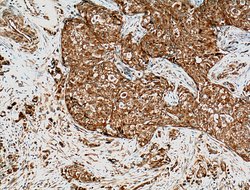 GTPBP3 Rabbit anti-Human, Mouse, Rat, Polyclonal, Proteintech 150 &mu;L;