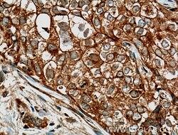 GTPBP3 Rabbit anti-Human, Mouse, Rat, Polyclonal, Proteintech 150 &mu;L;
