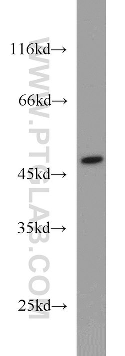 GTPBP3 Rabbit anti-Human, Mouse, Rat, Polyclonal, Proteintech 150 &mu;L;