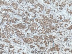 PRG2 Rabbit anti-Human, Polyclonal, Proteintech 150 &mu;L; Unconjugated:Antibodies,