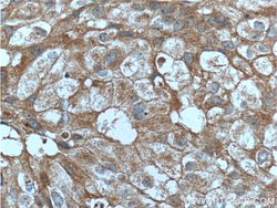 PRG2 Rabbit anti-Human, Polyclonal, Proteintech 150 &mu;L; Unconjugated:Antibodies,