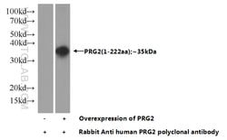 PRG2 Rabbit anti-Human, Polyclonal, Proteintech 150 &mu;L; Unconjugated:Antibodies,