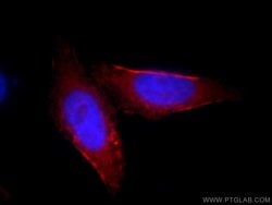 SEPT9 Rabbit anti-Human, Mouse, Rat, Polyclonal, Proteintech 150 &mu;L;