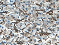 SEPT9 Rabbit anti-Human, Mouse, Rat, Polyclonal, Proteintech 150 &mu;L;