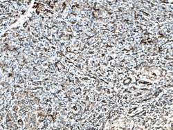 SEPT9 Rabbit anti-Human, Mouse, Rat, Polyclonal, Proteintech 150 &mu;L;
