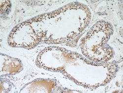 SEPT9 Rabbit anti-Human, Mouse, Rat, Polyclonal, Proteintech 150 &mu;L;