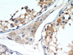 SEPT9 Rabbit anti-Human, Mouse, Rat, Polyclonal, Proteintech 150 &mu;L;
