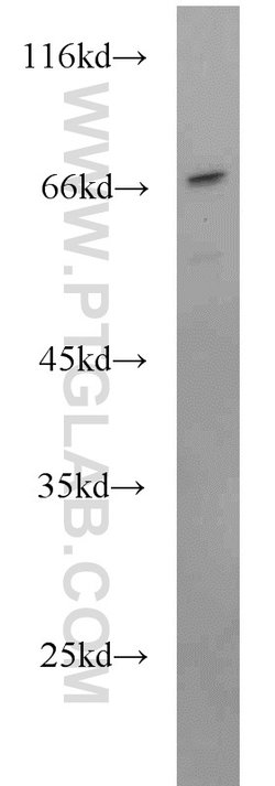 SEPT9 Rabbit anti-Human, Mouse, Rat, Polyclonal, Proteintech 150 &mu;L;