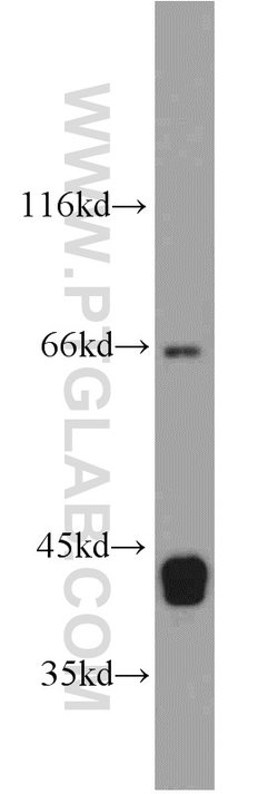 SEPT9 Rabbit anti-Human, Mouse, Rat, Polyclonal, Proteintech 150 &mu;L;