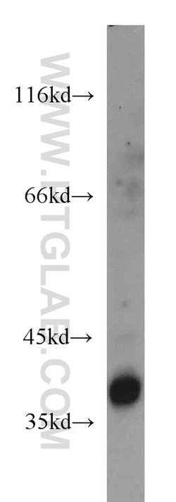 SEPT9 Rabbit anti-Human, Mouse, Rat, Polyclonal, Proteintech 150 &mu;L;
