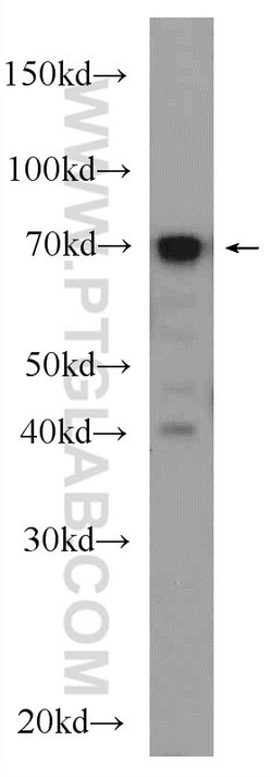SEPT9 Rabbit anti-Human, Mouse, Rat, Polyclonal, Proteintech 150 &mu;L;