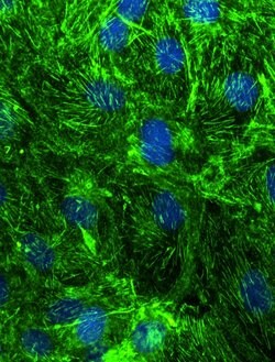 SEPT9 Rabbit anti-Human, Mouse, Rat, Polyclonal, Proteintech 150 &mu;L;