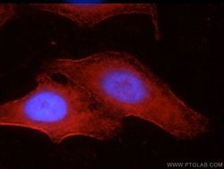 SEPT9 Rabbit anti-Human, Mouse, Rat, Polyclonal, Proteintech 150 &mu;L;