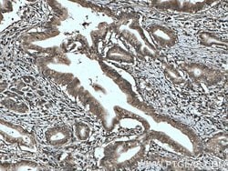 SEPT9 Rabbit anti-Human, Mouse, Rat, Polyclonal, Proteintech 150 &mu;L;