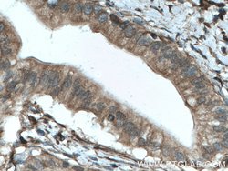 SEPT9 Rabbit anti-Human, Mouse, Rat, Polyclonal, Proteintech 150 &mu;L;
