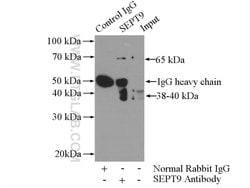 SEPT9 Rabbit anti-Human, Mouse, Rat, Polyclonal, Proteintech 150 &mu;L;