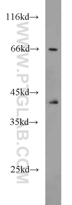 SEPT9 Rabbit anti-Human, Mouse, Rat, Polyclonal, Proteintech 150 &mu;L;