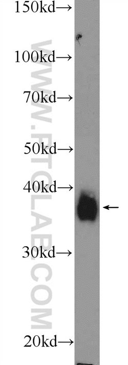 MSI2 Rabbit anti-Human, Mouse, Rat, Polyclonal, Proteintech:Antibodies:Primary