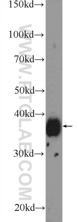 MSI2 Rabbit anti-Human, Mouse, Rat, Polyclonal, Proteintech:Antibodies:Primary
