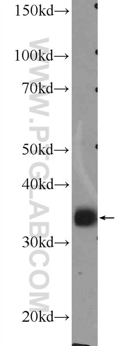 MSI2 Rabbit anti-Human, Mouse, Rat, Polyclonal, Proteintech:Antibodies:Primary
