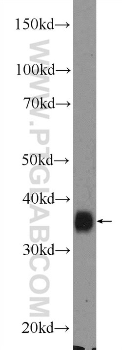 MSI2 Rabbit anti-Human, Mouse, Rat, Polyclonal, Proteintech:Antibodies:Primary