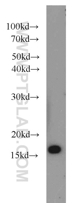 SNX3 Rabbit anti-Human, Mouse, Rat, Polyclonal, Proteintech 20 &mu;L; Unconjugated:Antibodies,
