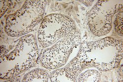 SFTPC Rabbit anti-Human, Rat, Polyclonal, Proteintech:Antibodies:Primary